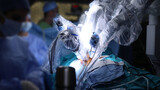 Robotic Surgery. Medical operation involving robot. Medical robot. Minimally Invasive Robotic Surgery. 