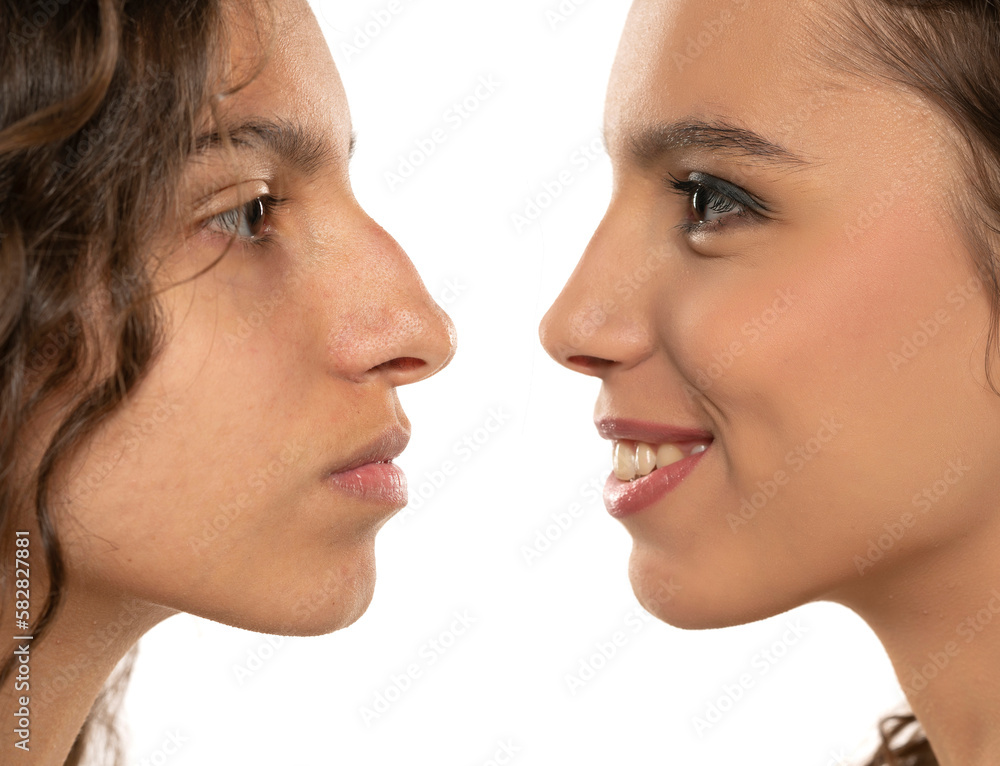 Woman Rhinoplasty. Women Nose Shape Before and After Plastic Surgery. Woman Profile Side View over isolated White Background Woman Rhinoplasty. Women Nose Shape Before and After Plastic Surgery. Woman Profile Side View over isolated White Background