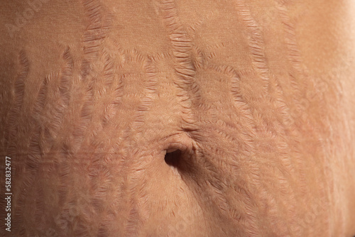 Obraz na płótnie Close up human Skin natural stretch marks Texture background