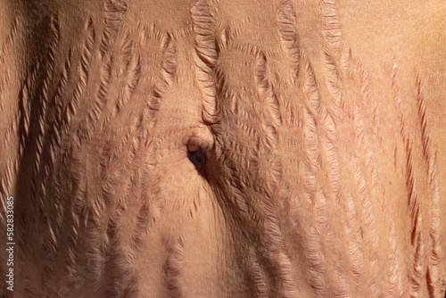 Obraz na płótnie Close up human Skin natural stretch marks Texture background