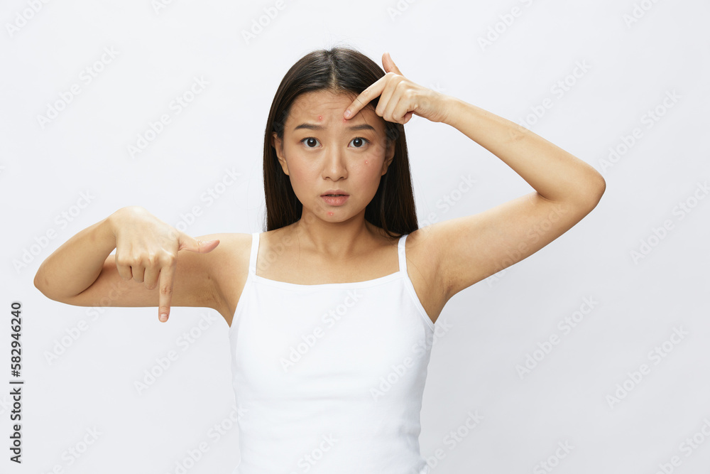 Asian woman facial skin problems, acne and inflammation, red rashes and allergies, chicken pox, sadness from rashes. Facial skin care concept for diseases and nerves Asian woman facial skin problems, acne and inflammation, red rashes and allergies, chicken pox, sadness from rashes. Facial skin care concept for diseases and nerves