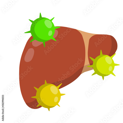 Bad liver. Attack germs and cirrhosis of the liver. Health problem