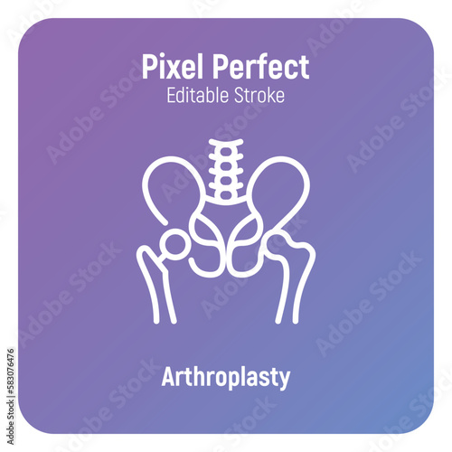 Arthroplasty thin line icon, artificial joint, surgical procedure to restore joint. Arthritis. Pixel perfect, editable stroke. Vector illustration.