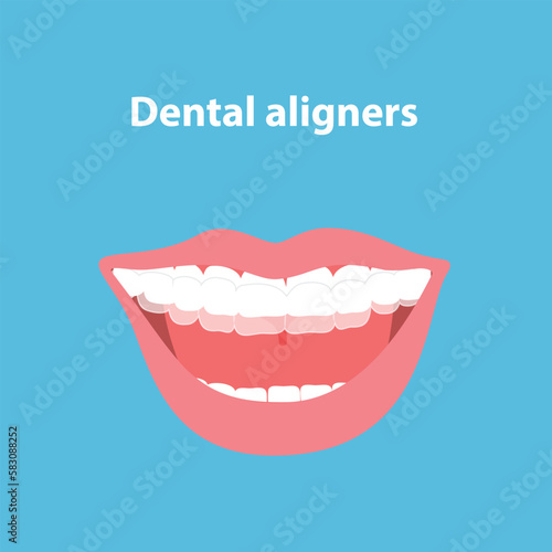 Alignment of teeth by aligners. Orthodontic dentistry concept