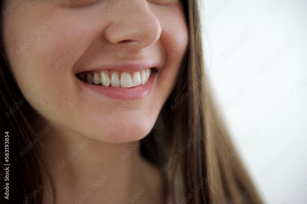 Close-up of a smiling woman in a transparent plastic bleaching tray. Removable retainer for perfectly straight teeth. Widescreen. Young woman with beautiful smile, closeup. Teeth whitening Close-up of a smiling woman in a transparent plastic bleaching tray. Removable retainer for perfectly straight teeth. Widescreen. Young woman with beautiful smile, closeup. Teeth whitening