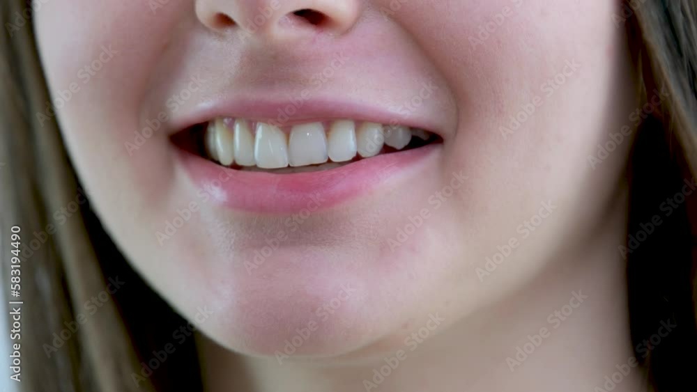 Close-up of a smiling woman in a transparent plastic bleaching tray. Removable retainer for perfectly straight teeth. Widescreen. Young woman with beautiful smile, closeup. Teeth whitening Close-up of a smiling woman in a transparent plastic bleaching tray. Removable retainer for perfectly straight teeth. Widescreen. Young woman with beautiful smile, closeup. Teeth whitening