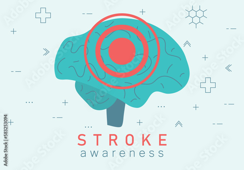 Stroke awareness. Prevention for stroke. Transient ischemic attack, ischemic stroke, hemorrhagic stroke. Ischemic, atherosclerosis and hemorrhagic disease