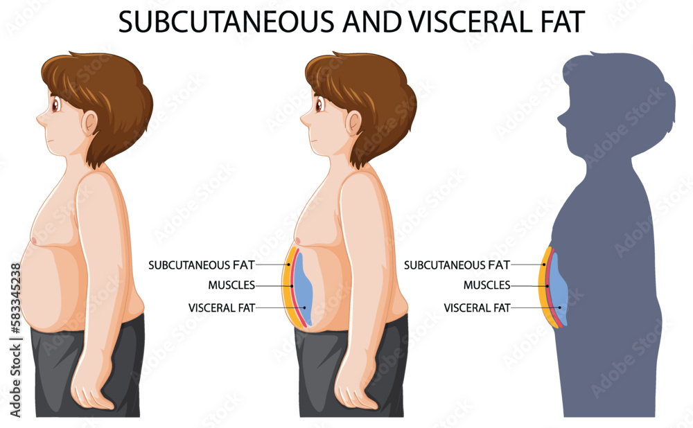 Subcutaneous and visceral fat diagram Stock Vector Adobe Stock