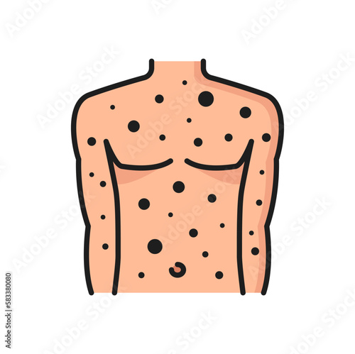 Allergy rash or acne color line icon. Seasonal health problem, disease or allergic reaction outline vector symbol. Food or cloth material allergy symptom pictogram or icon with skin rash on man torso