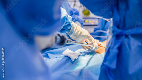 Surgeon or doctor in blue gown put medical instrument or device at camera portal during laparoscopic cholecystectomy inside operating room.Keyhole surgery technology in obesity surgical treatment.