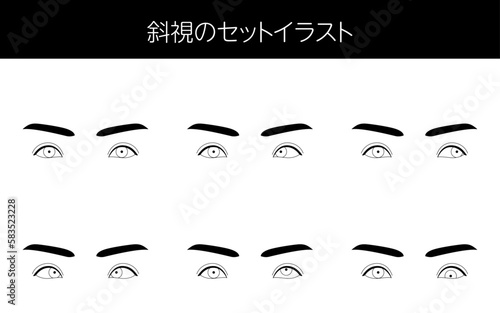 医療イラスト、眼病・斜視の図解セットイラスト