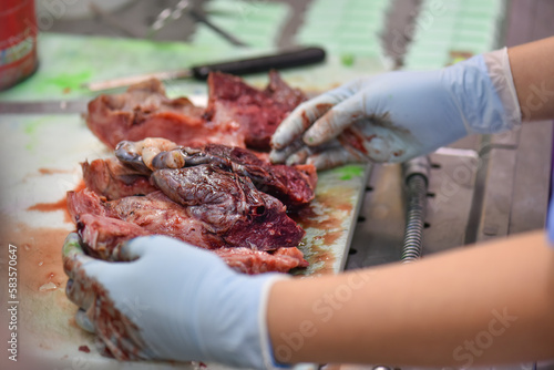 A pathologist is preparing a pathological biopsy for laboratory diagnosis of pathology.