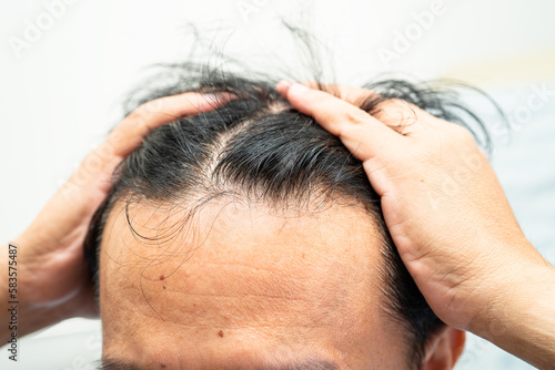 Bald at front of head and begin no loss hair glabrous of mature Asian business smart active office man.