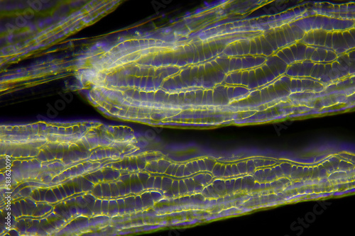 Microscopic view of peat moss (Sphagnum) leaves. Darkfield illumination.