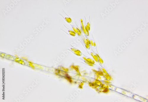 Microscopic view of algae colony (Dinobryon) on green algae filament. Brightfield illumination.