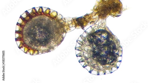 Fern sporangium under light microscope. 10x objective lens. Focus stacked image photo