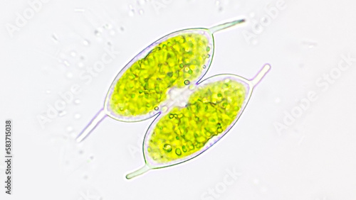 Obraz na plátně Freshwater green microalgae, Staurodesmus convergens