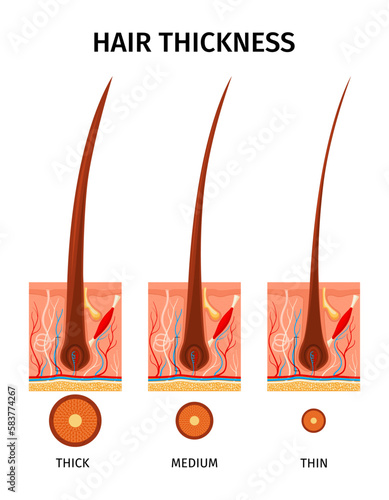 Hair Thickness Types Composition
