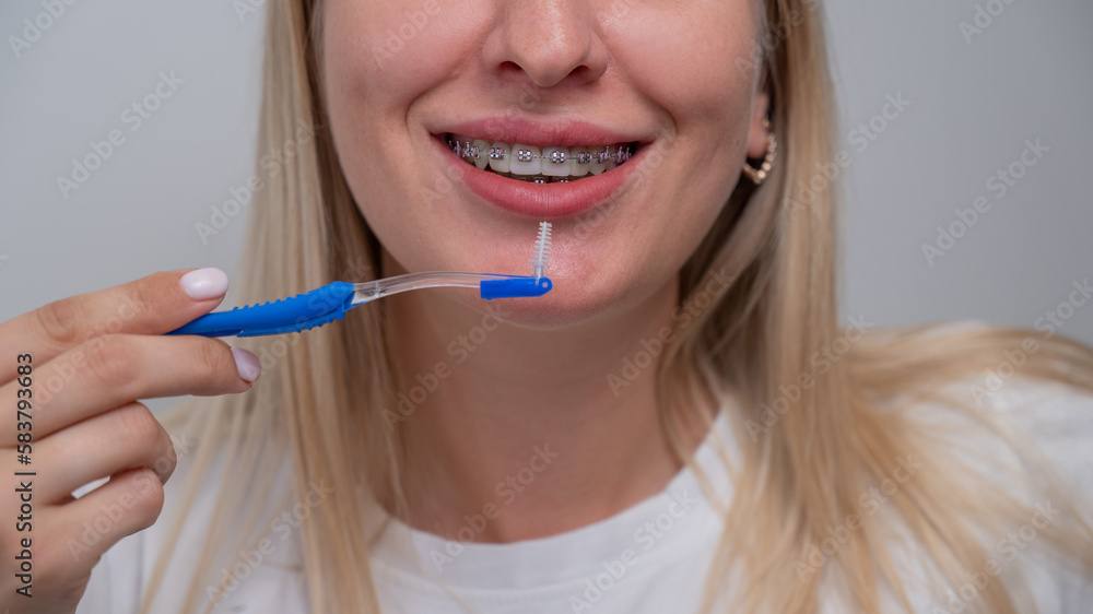 Caucasian woman cleaning her teeth with braces using a brush. Cropped portrait. Caucasian woman cleaning her teeth with braces using a brush. Cropped portrait.