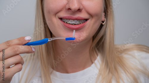 Caucasian woman cleaning her teeth with braces using a brush. Cropped portrait. 