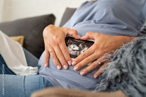 Beautiful pregnant woman looking a cute baby clothes and ultrasound picture at home. Anticipation of a child birth. © lordn