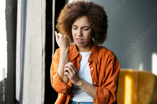 Multi-ethnic woman scratches her reddened hand due to itching. Allergy symptoms. Healthcare concept