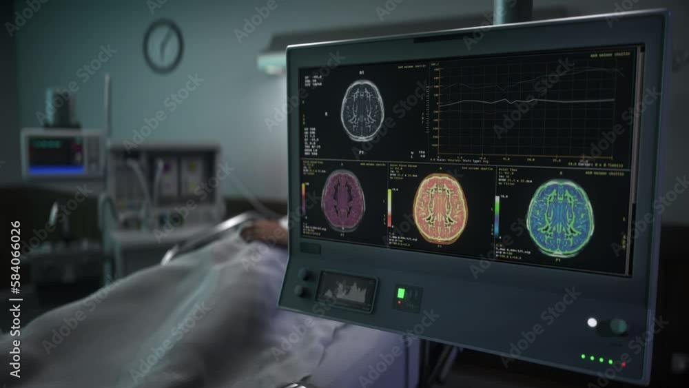 Vidéo Stock Modern Medical Clinic Laboratory System Checks Brain For Cancer With Xray Analysis