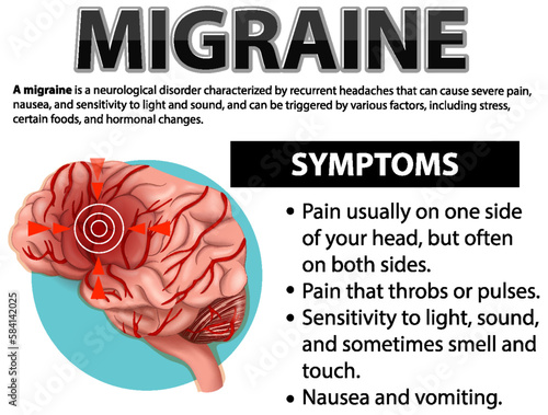 Informative poster of Migraine