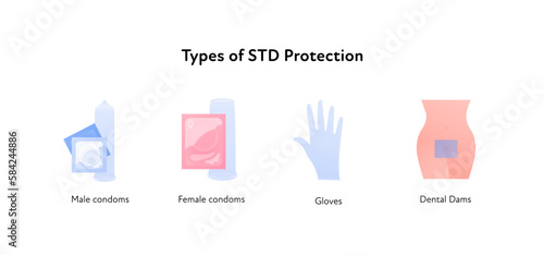 Sexual transmitted disease infographic. Vector flat healthcare illustration set. Types of STD infection protection. Male and female condoms, gloves, dental dam symbol. Design for health care photo