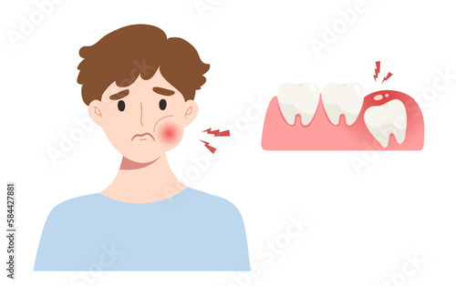 Young man suffering from wisdom tooth. Concept of impacted tooth pain, dentistry, dental illustration, oral health, toothache. 