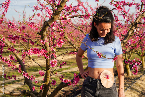 woman in a field of pink flowers looking at the colostomy bag in spring. colon cancer day photo