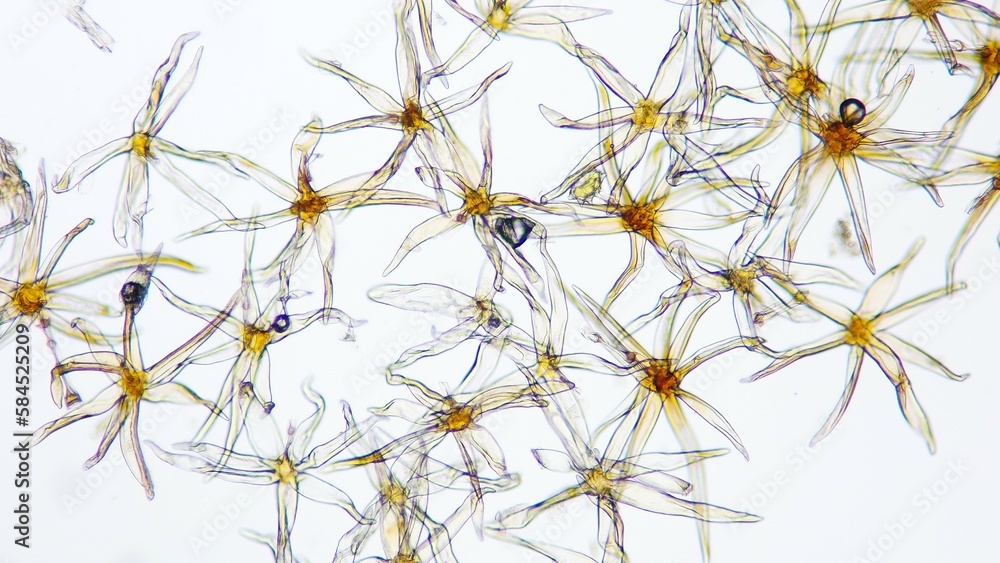 Trichomes (leaf hairs) of fern. Fresh sample. 100x magnification. Selective focus Trichomes (leaf hairs) of fern. Fresh sample. 100x magnification. Selective focus