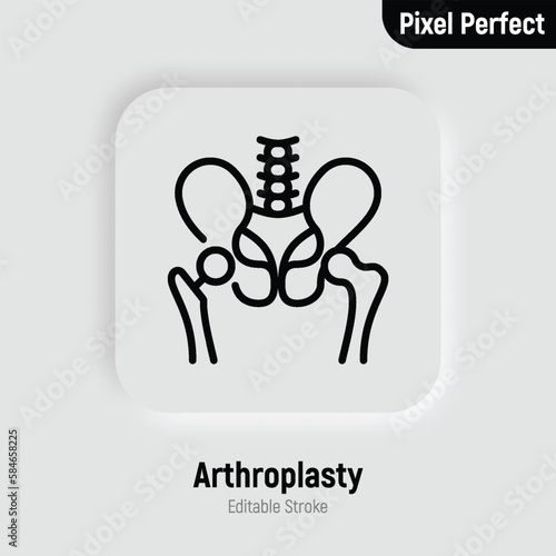 Arthroplasty thin line icon, artificial joint, surgical procedure to restore joint. Arthritis. Pixel perfect, editable stroke. Vector illustration.