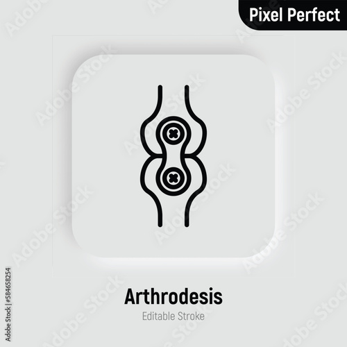 Arthrodesis joint surgery thin line icon. Arthritis. Pixel perfect, editable stroke. Vector illustration.
