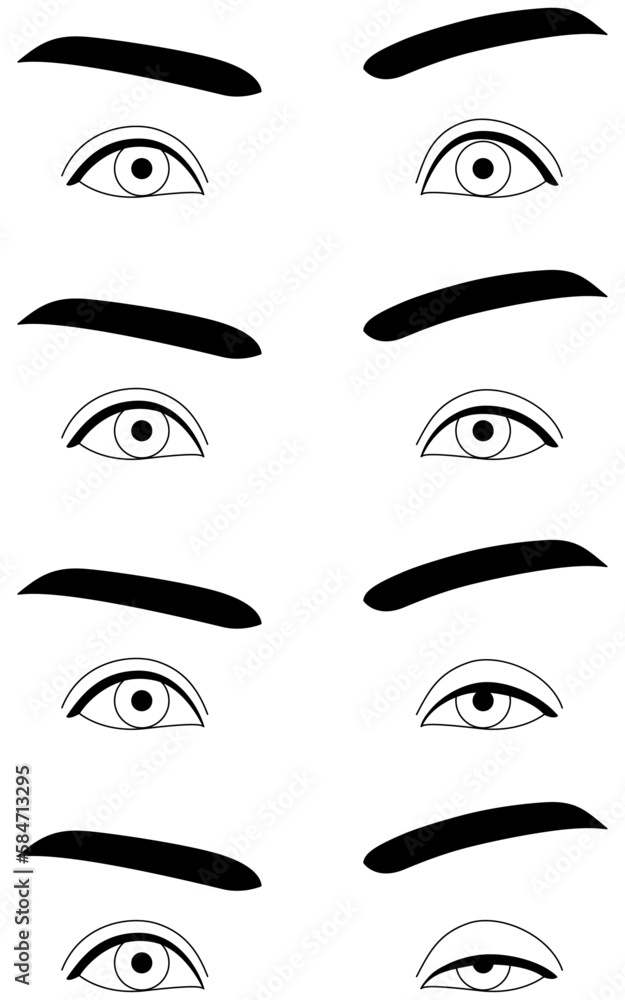 医療イラスト、眼瞼下垂の症状 正常~重症 医療イラスト、眼瞼下垂の症状 正常~重症