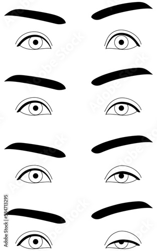 医療イラスト、眼瞼下垂の症状　正常～重症
