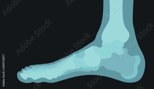 Leg 3D x ray shot human anatomy bone medical diagnostic patient radiology scan vector illustration