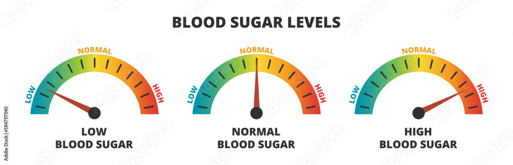 Vector infographic set of blood sugar levels – glucose meters with low, normal, and high level results, diabetes, prediabetes. Indicator gauge with color scale and arrow showing blood sugar levels. Vector infographic set of blood sugar levels – glucose meters with low, normal, and high level results, diabetes, prediabetes. Indicator gauge with color scale and arrow showing blood sugar levels.