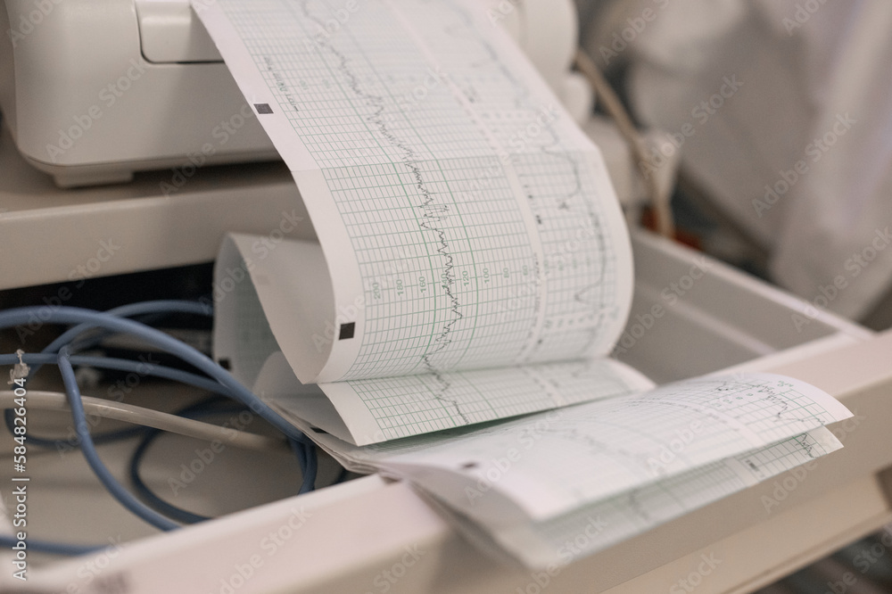 Electrocardiogram Collection Electrocardiogram strip in opened drawer Stock Photo | Adobe Stock