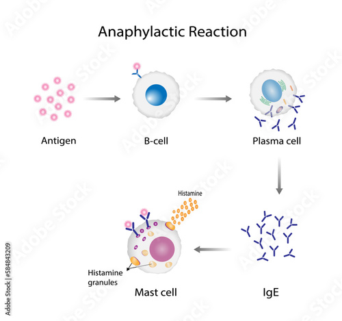 Anaphylactic reaction, allergic reaction, Autoimmune disorders, allergy and anaphylaxis. Mast cells, b cell, basophils and IgE antibodies are in involved in Anaphylactic reaction.