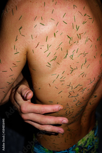 Wellness Needle Treatment Fir Branches After Sauna