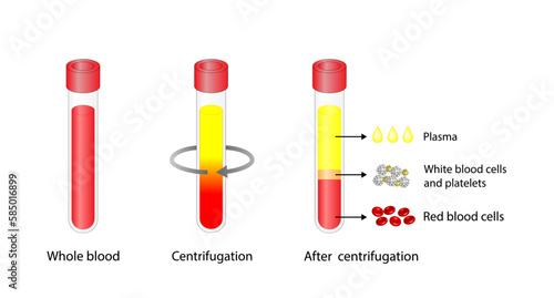 Blood centrifugation. Platelets, red blood (erythrocytes) and white blood cells (leukocytes). Platelet-rich plasma (prp).Medical test tube, Glassware or flask. Vector educational illustration.