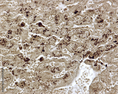 Liver. Hepatocyte. Lipid droplets. Tissue fixed in osmium tetroxide photo