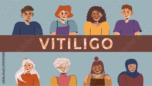different people with vitiligo. Love yourself. Banner with women and men of different nationalities on a blue background