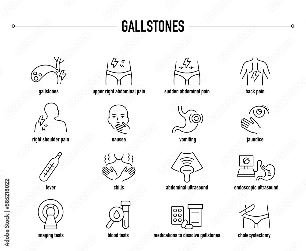 Gallstones symptoms, diagnostic and treatment vector icon set. Line editable medical icons.