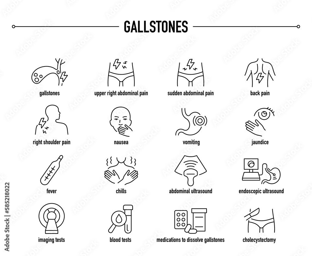 Gallstones symptoms, diagnostic and treatment vector icon set. Line editable medical icons. Gallstones symptoms, diagnostic and treatment vector icon set. Line editable medical icons.