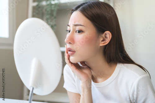 Wallpaper Mural Dermatology, scratch asian young woman looking at mirror, expression worry and itch, itchy allergy or allergic sensitive reaction, red spot or rash on her face. Beauty care from skin problem treatment Torontodigital.ca