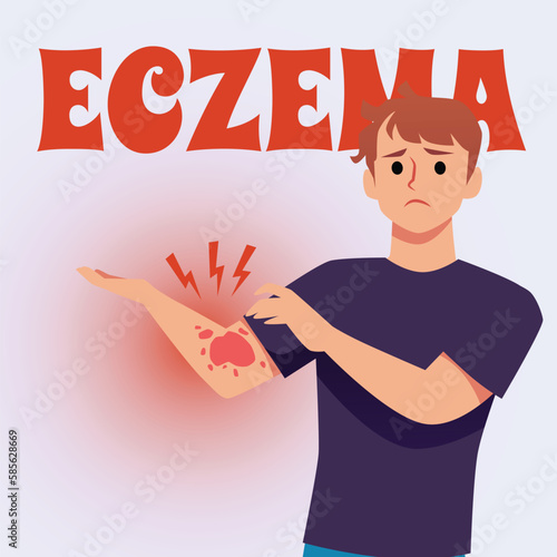 Sad man suffering from eczema, poster template with text, flat vector illustration.