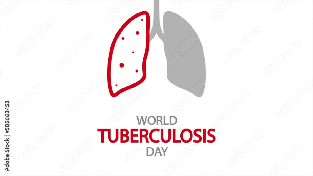 World TB Day red lung, art video illustration. World TB Day red lung, art video illustration.