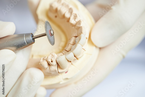 Wallpaper Mural Dentures being trimmed with a dental drill piece	 Torontodigital.ca